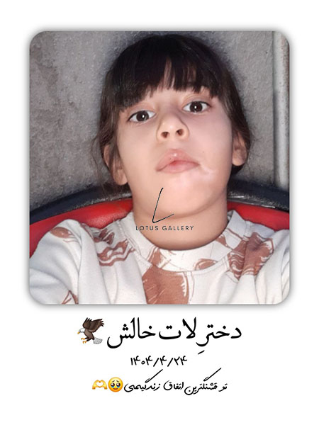  نوزادی - پرامپت