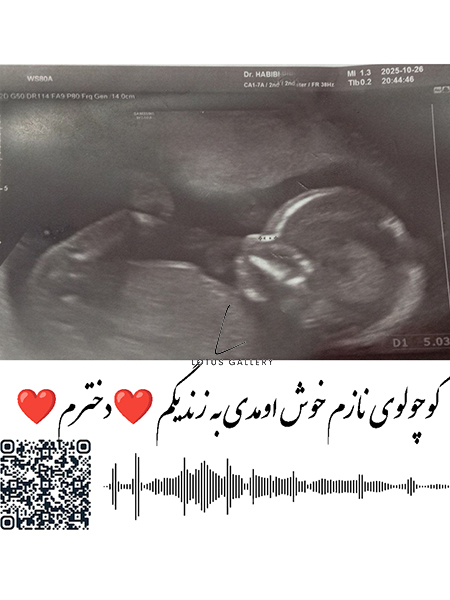  نوزادی - پرامپت